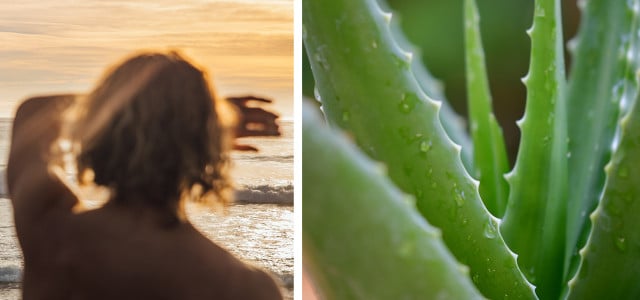 natural remedies for sunburn
