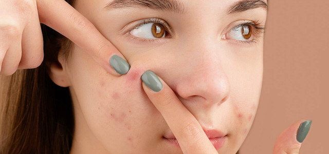 how to stop skin picking