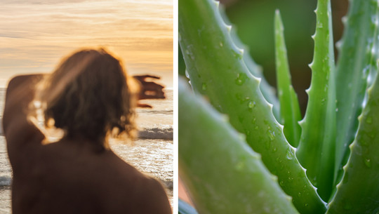 natural remedies for sunburn